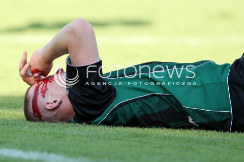  17.08.2013 STALOWA WOLA <br />PILKA NOZNA POLSKA PUCHAR POLSKI SEZON 2013/2014 FOOTBALL POLISH CUP SEASON 2013/2014 STAL STALOWA WOLA - SLASK WROCLAW<br />N/Z ARTUR CEBULA KREW FAUL KONTUZJA GLOWA ROZCIETA EMOCJE BOL URAZ<br /> 
