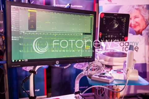  12.01.2014 WARSZAWA 22. FINAL WIELKIEJ ORKIESTRY SWIATECZNEJ POMOCY N/Z SPRZET MEDYCZNY  